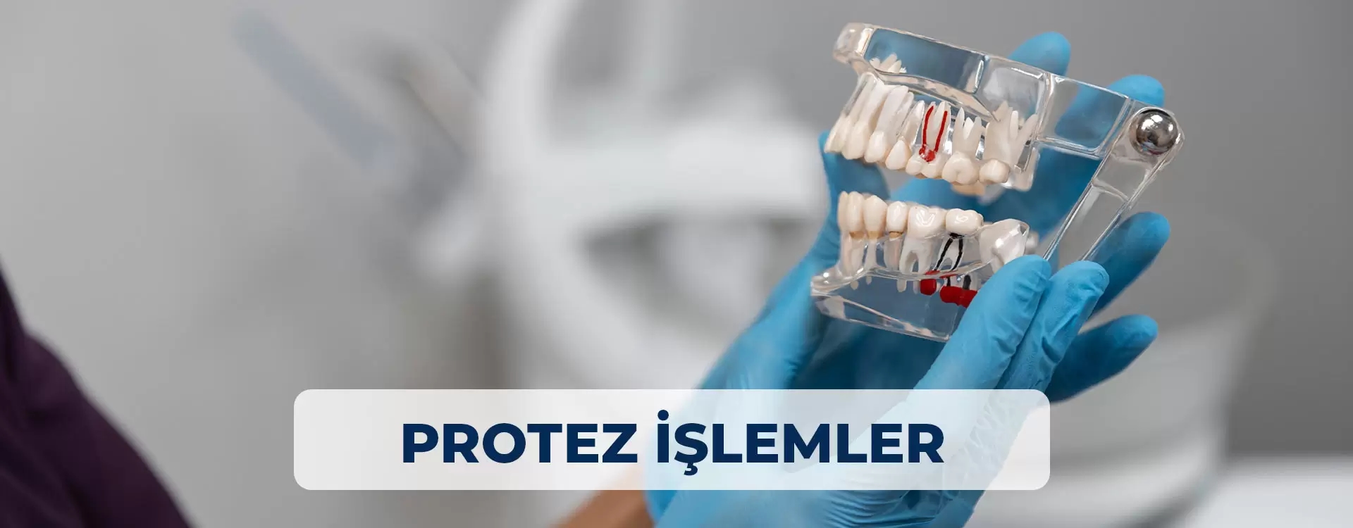 Protez İşlemler